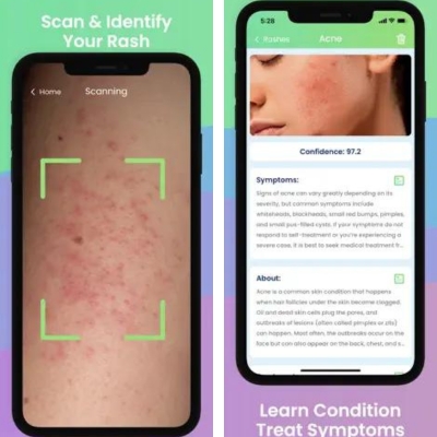 Aplicativos para escanear manchas na pele