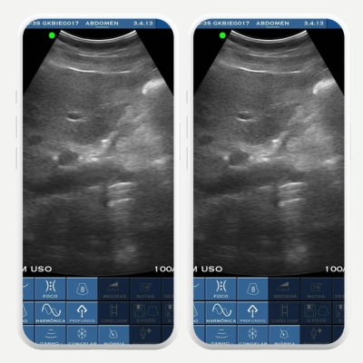 Aplicativos para fazer ultrassom pelo celular